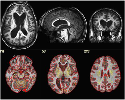 Quality control procedures and metrics for resting-state functional MRI